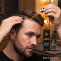 Organic Hairoids Hair & Beard Growth Oil - 100ML