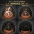 Organic Hairoids King of Bel Hair Kit