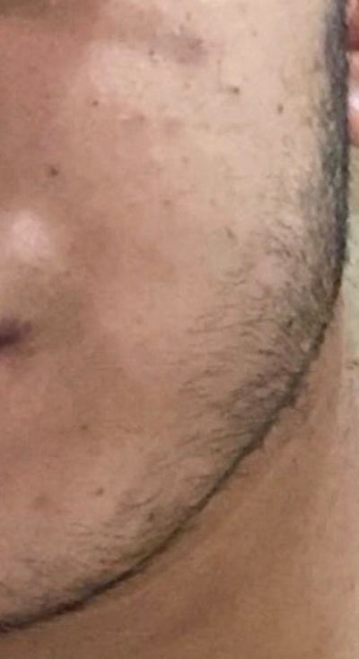 Before – 90 Days