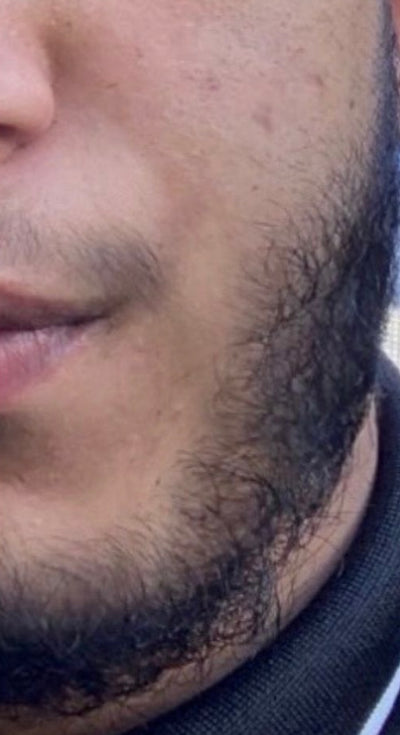 After – 90 Days