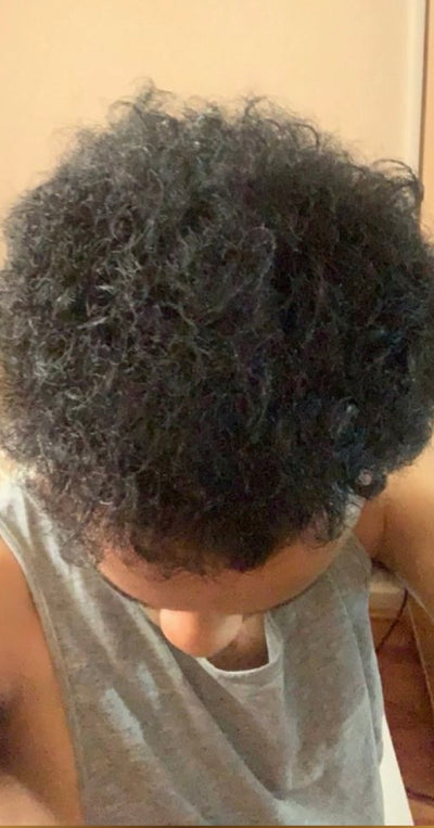 After – 90 Days