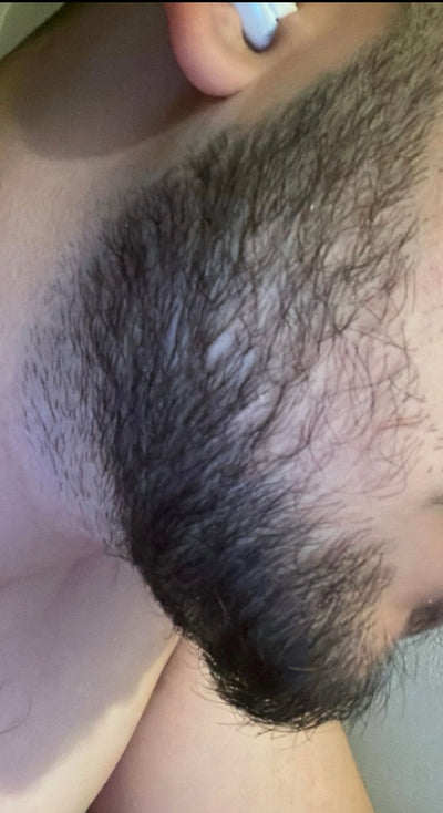 After – 90 Days