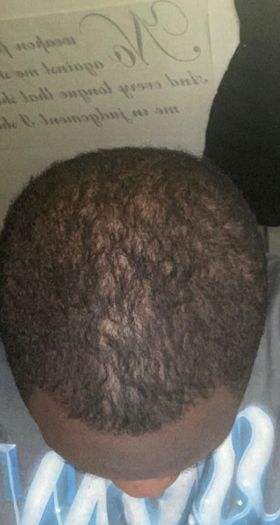 Before – 90 Days