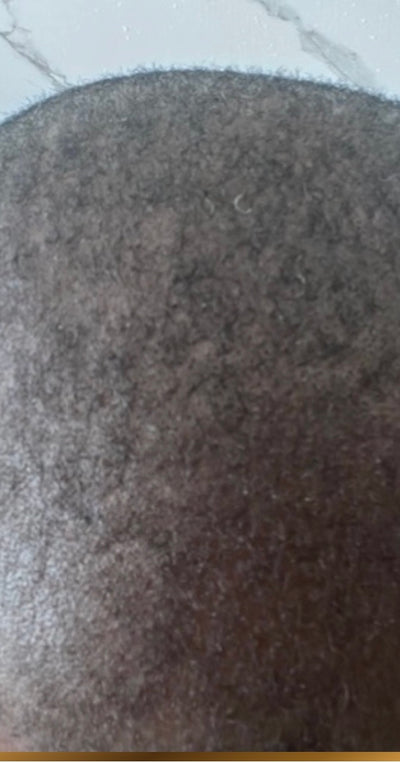 After – 90 Days