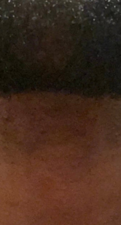 After – 90 Days