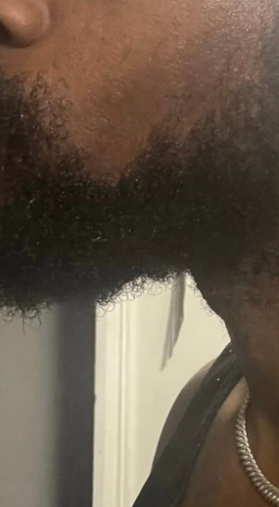 Before – 90 Days