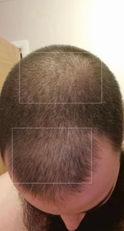 Before – 90 Days
