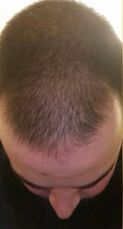 After – 90 Days