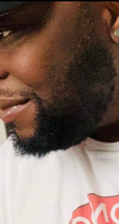 After – 90 Days