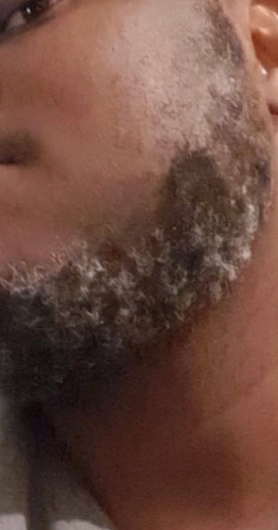 After – 90 Days