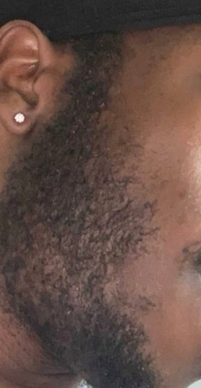 After – 90 Days