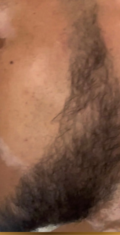 After – 90 Days